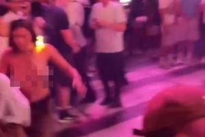 纽约G3赛后惊现女球迷上衣被扒头发被烧，情况危急！